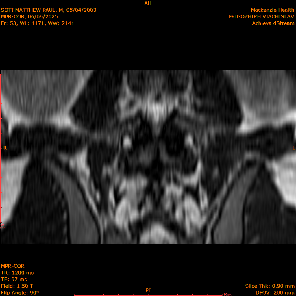 2025-06-09/MPR-COR/0054-IM115.png