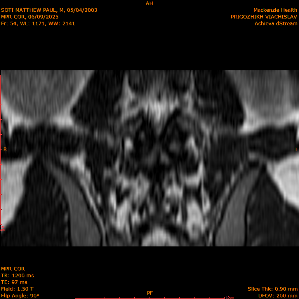 2025-06-09/MPR-COR/0055-IM116.png