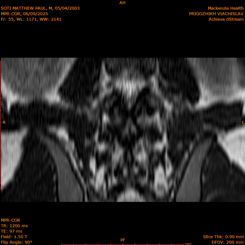 2025-06-09/MPR-COR/0056-IM117.png
