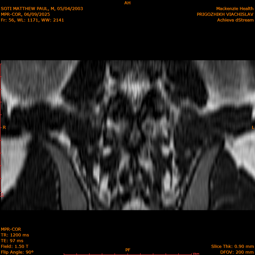 2025-06-09/MPR-COR/0057-IM118.png