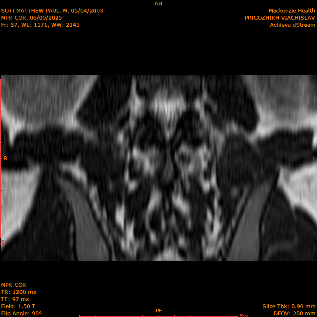 2025-06-09/MPR-COR/0058-IM119.png