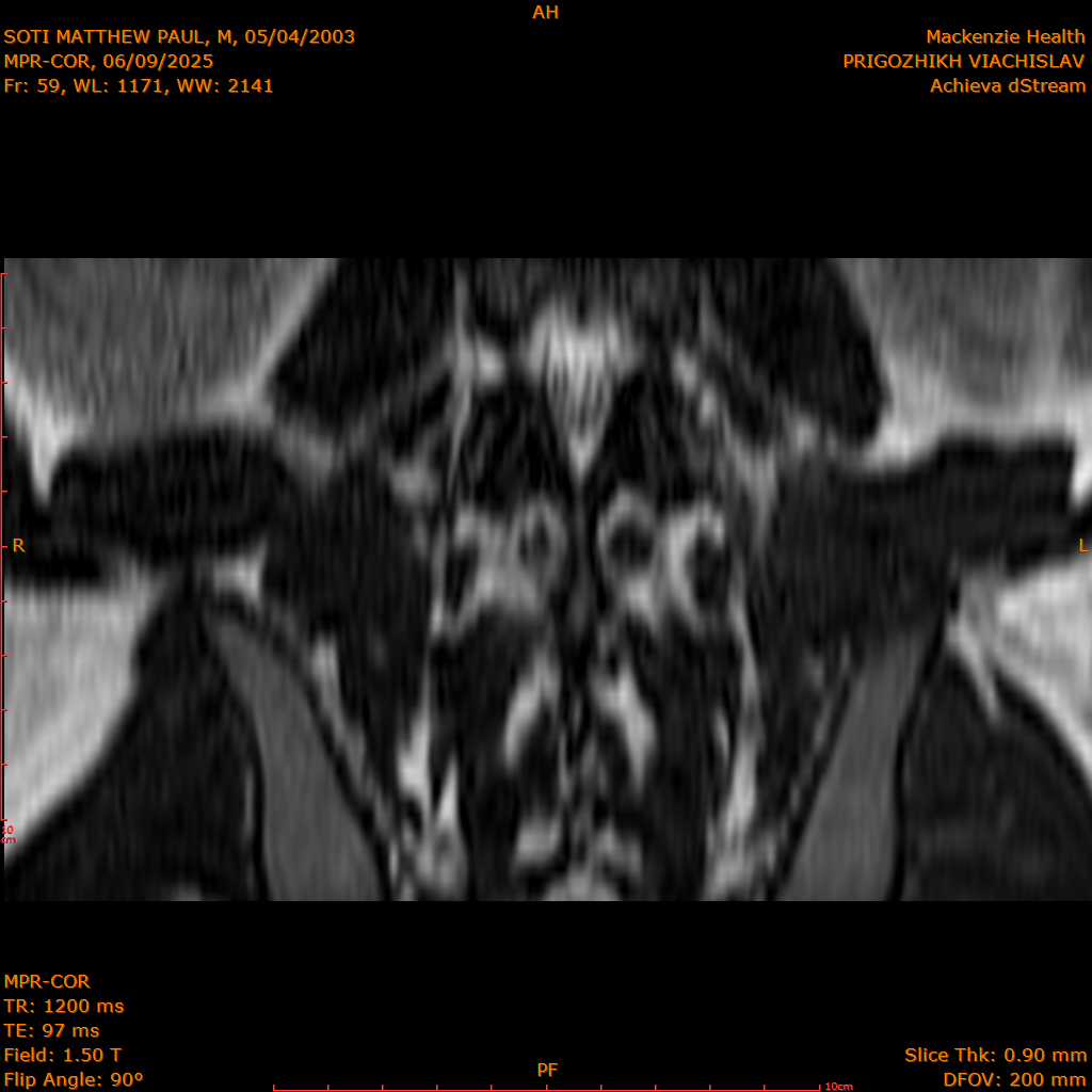 2025-06-09/MPR-COR/0060-IM121.png