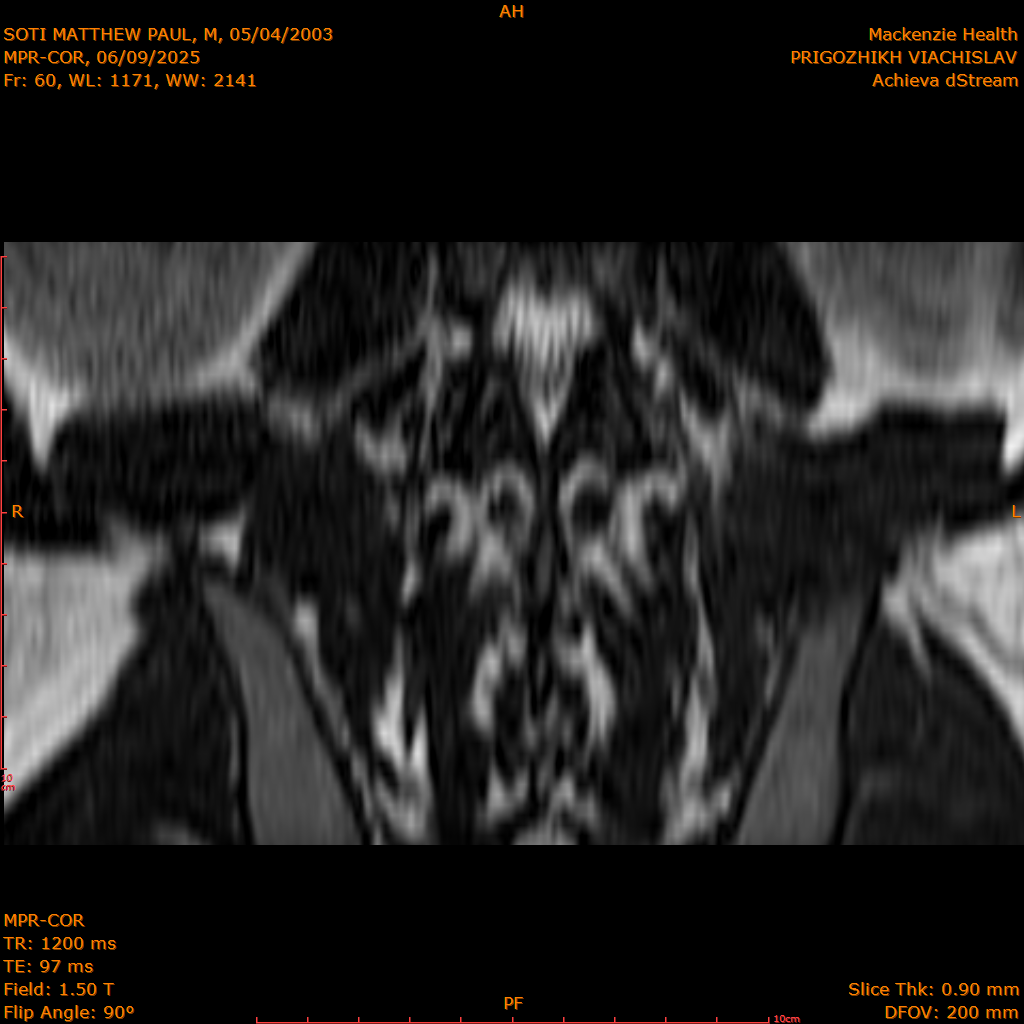 2025-06-09/MPR-COR/0061-IM122.png