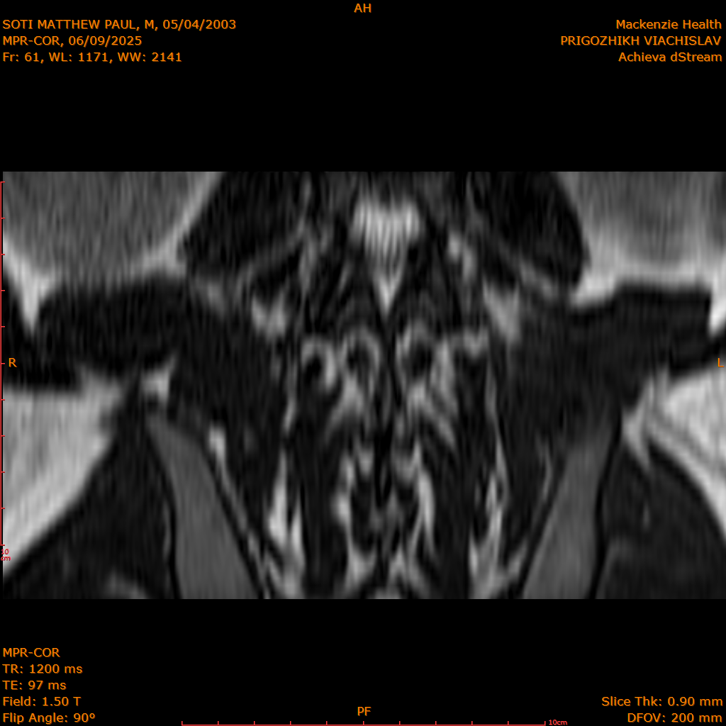 2025-06-09/MPR-COR/0062-IM123.png