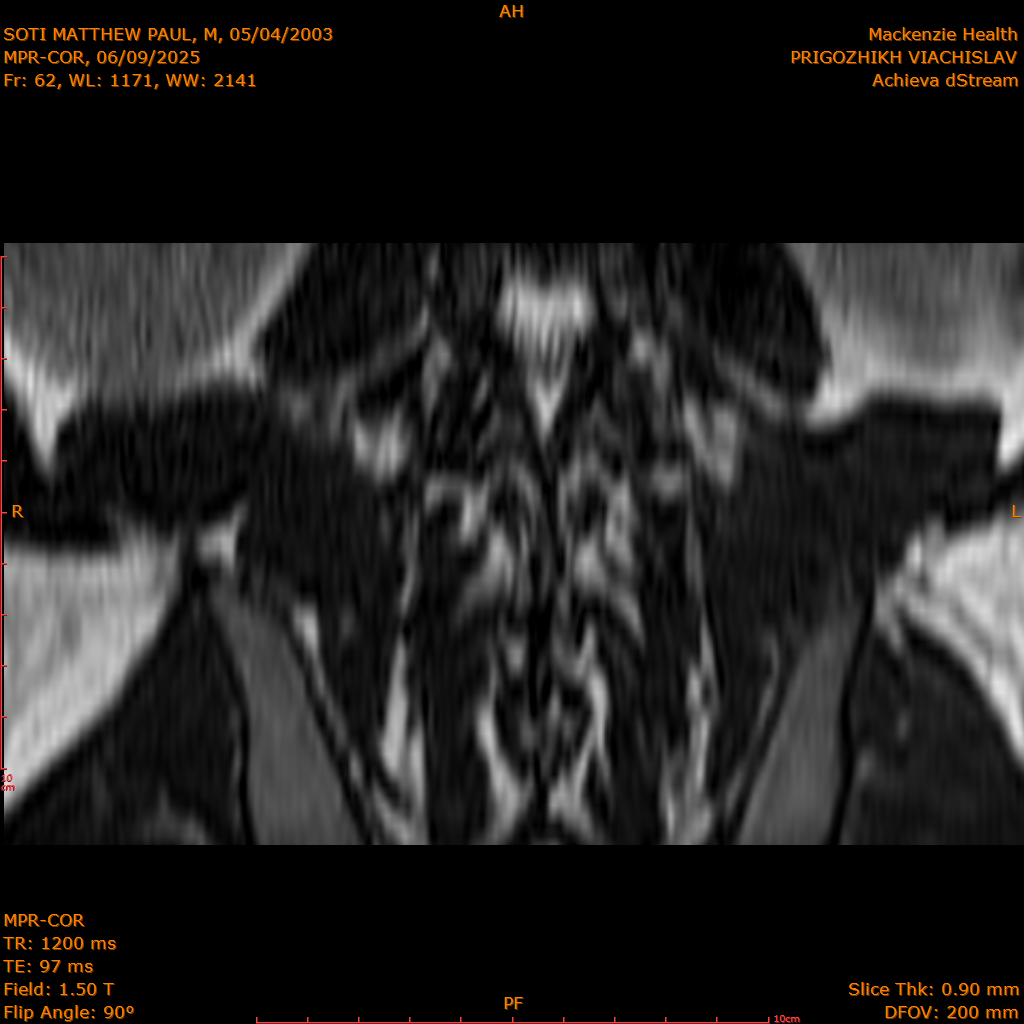 2025-06-09/MPR-COR/0063-IM124.png