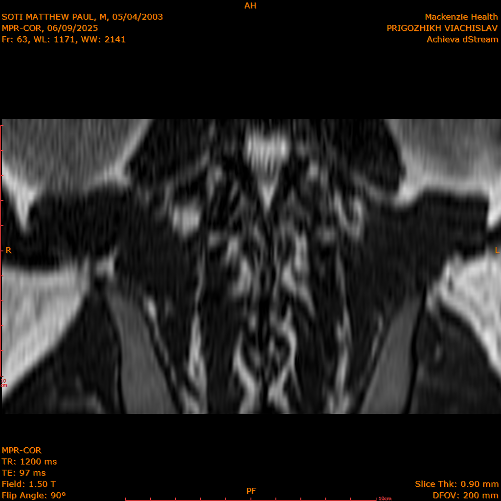 2025-06-09/MPR-COR/0064-IM125.png
