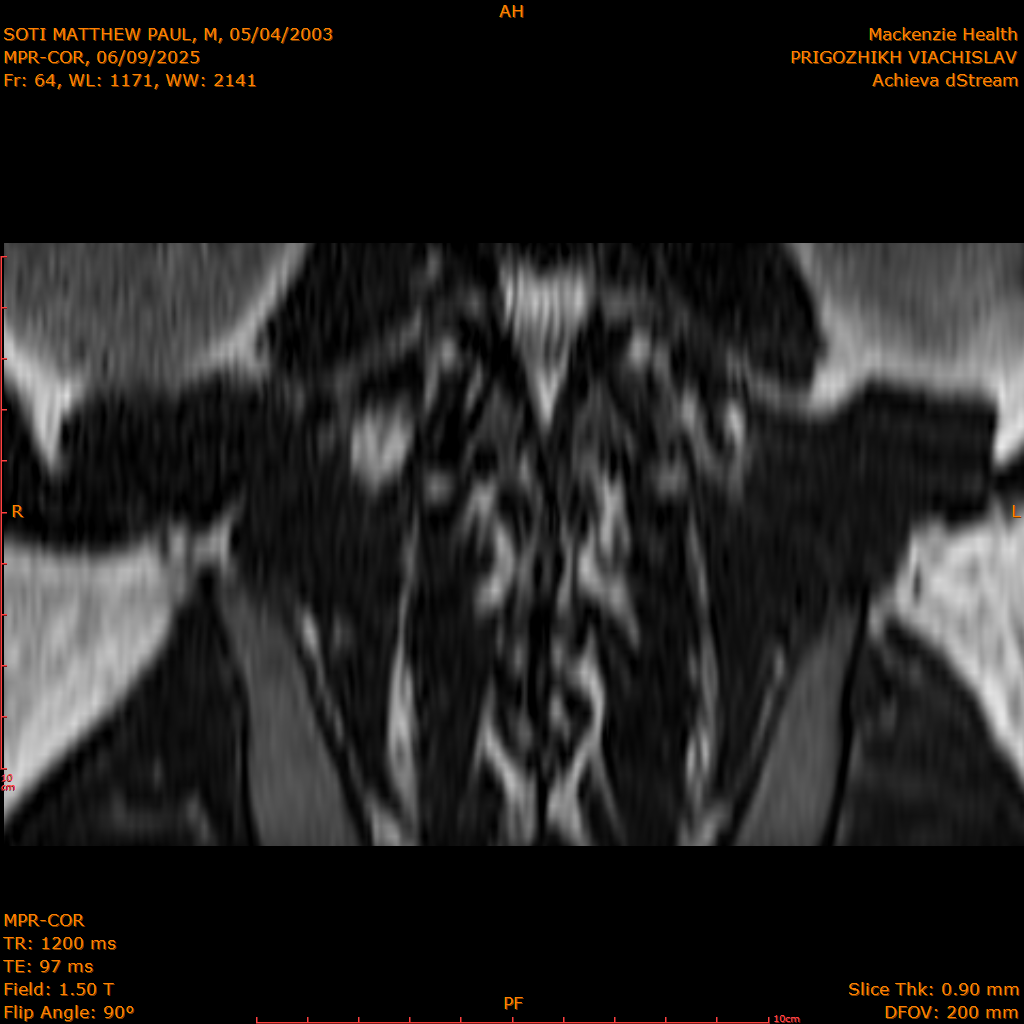 2025-06-09/MPR-COR/0065-IM126.png
