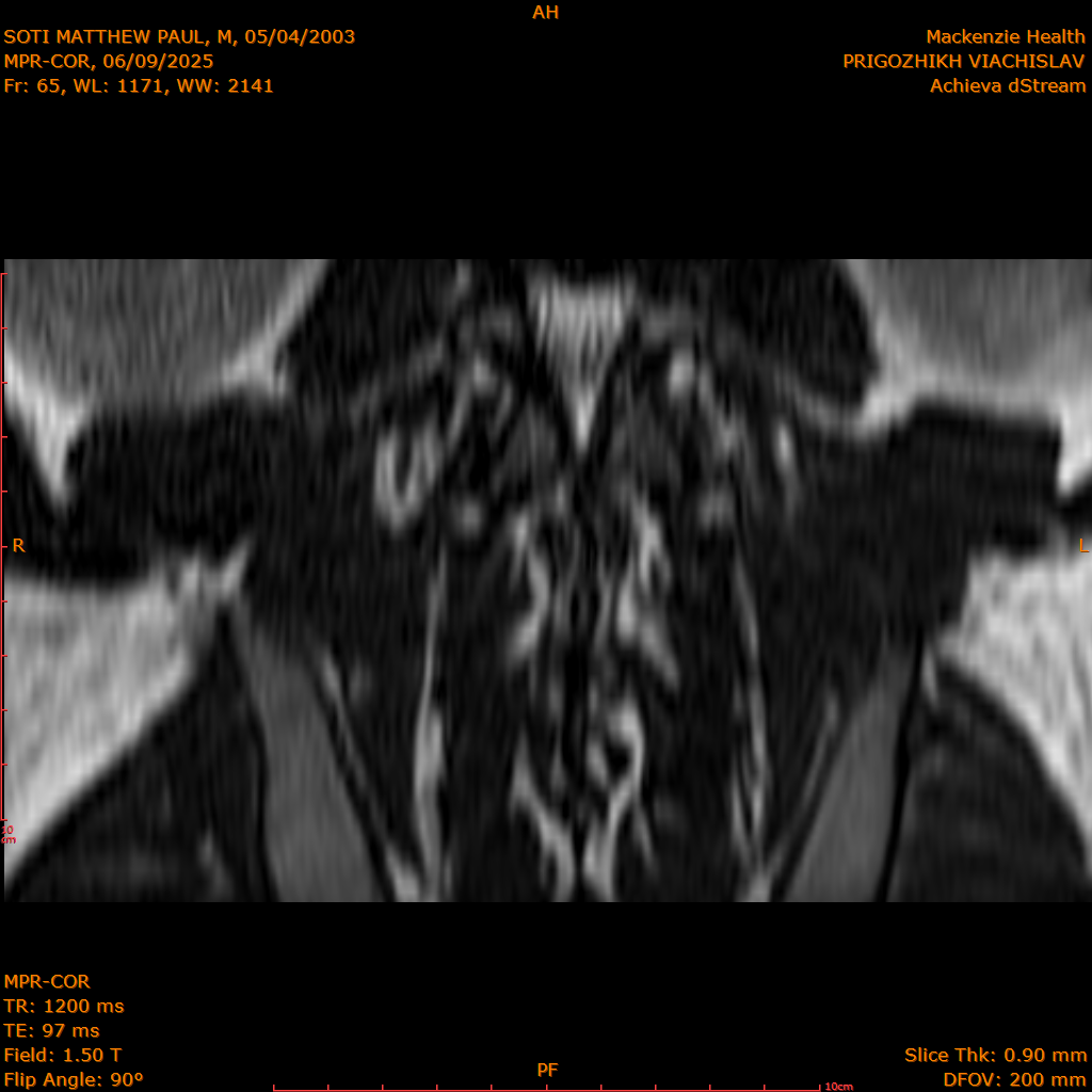2025-06-09/MPR-COR/0066-IM127.png