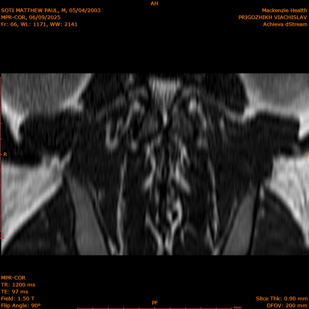 2025-06-09/MPR-COR/0067-IM128.png