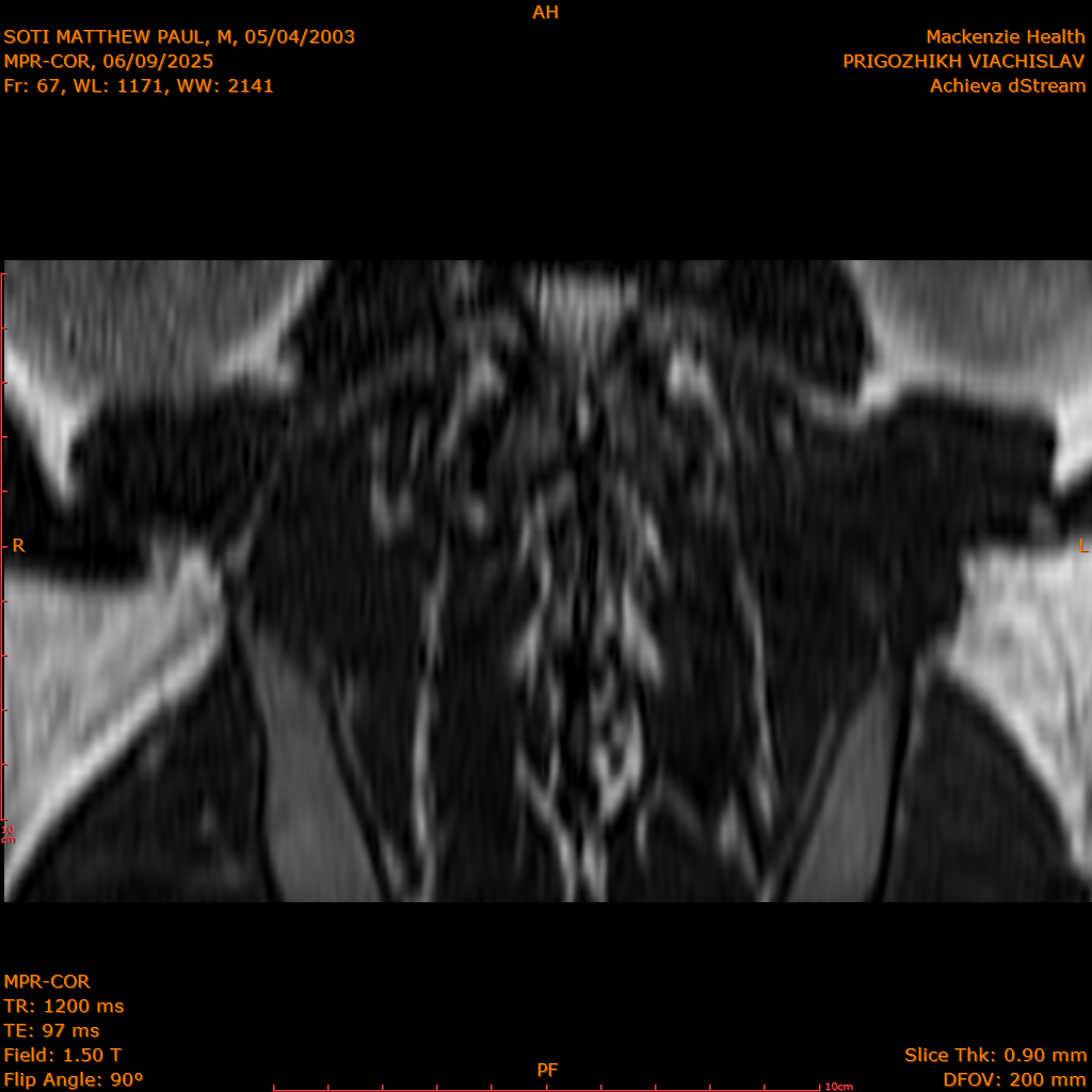 2025-06-09/MPR-COR/0068-IM129.png