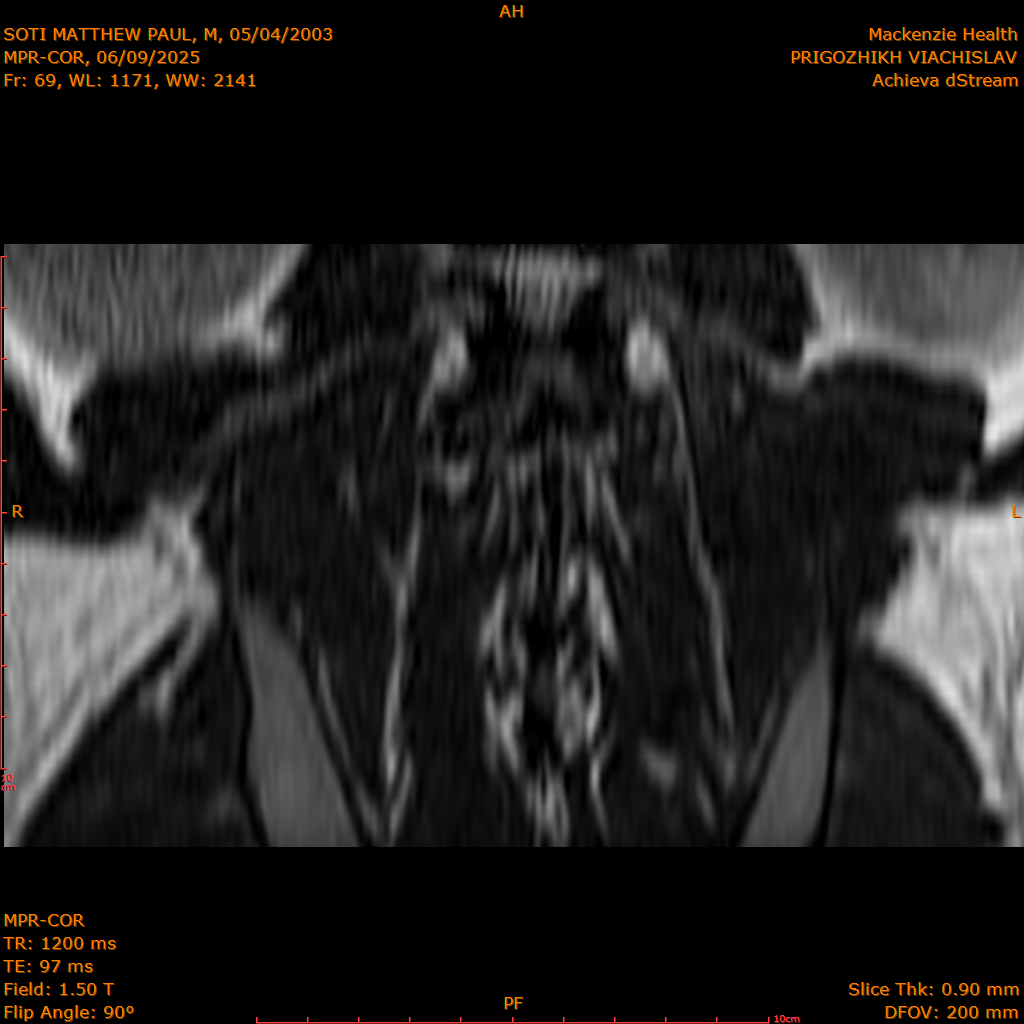 2025-06-09/MPR-COR/0070-IM131.png