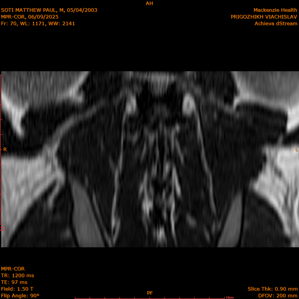 2025-06-09/MPR-COR/0071-IM132.png
