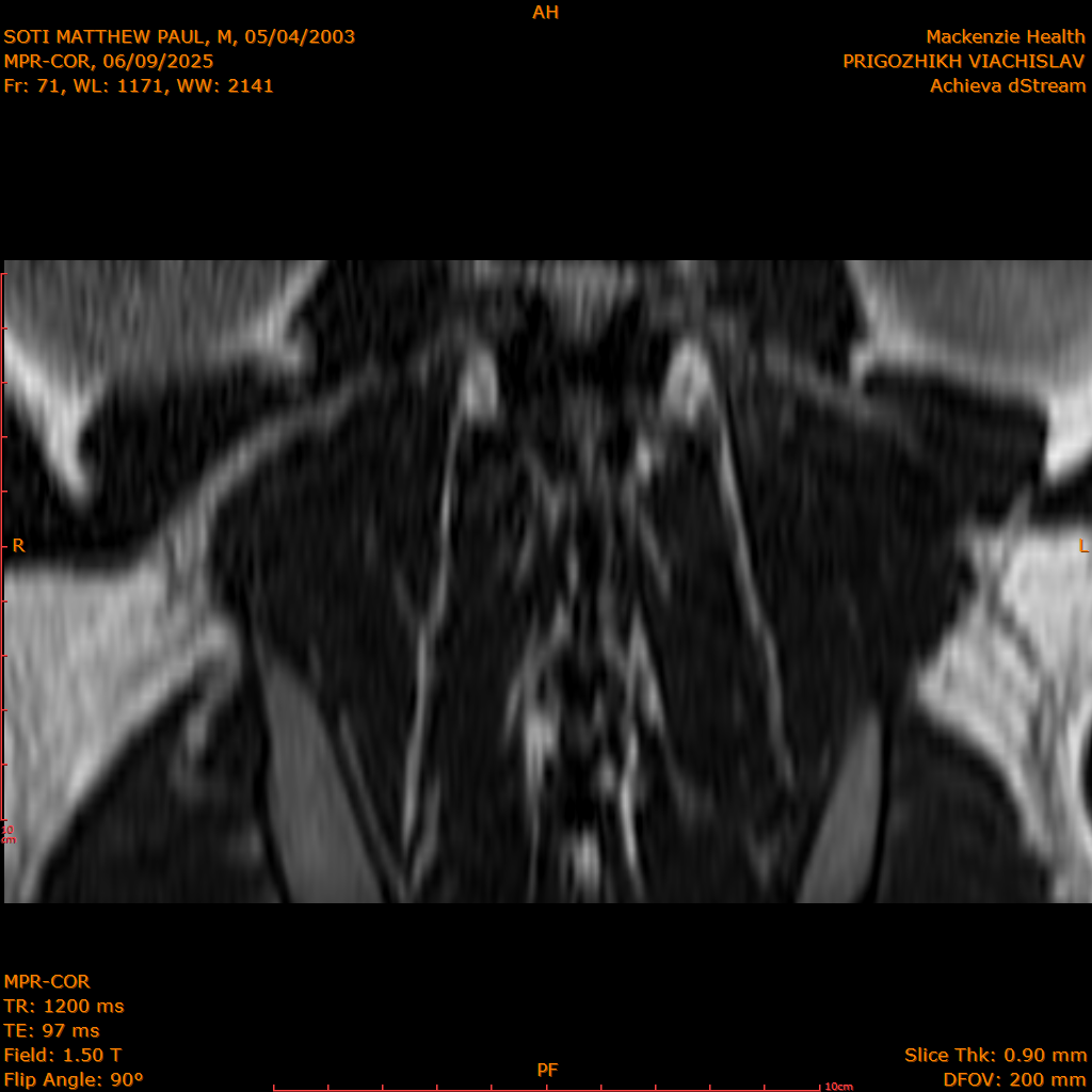 2025-06-09/MPR-COR/0072-IM133.png