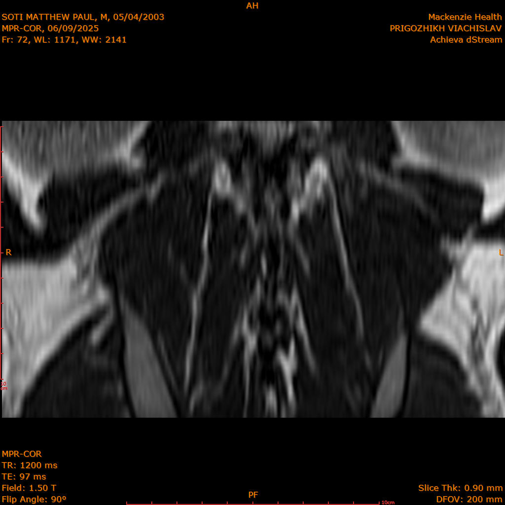 2025-06-09/MPR-COR/0073-IM134.png
