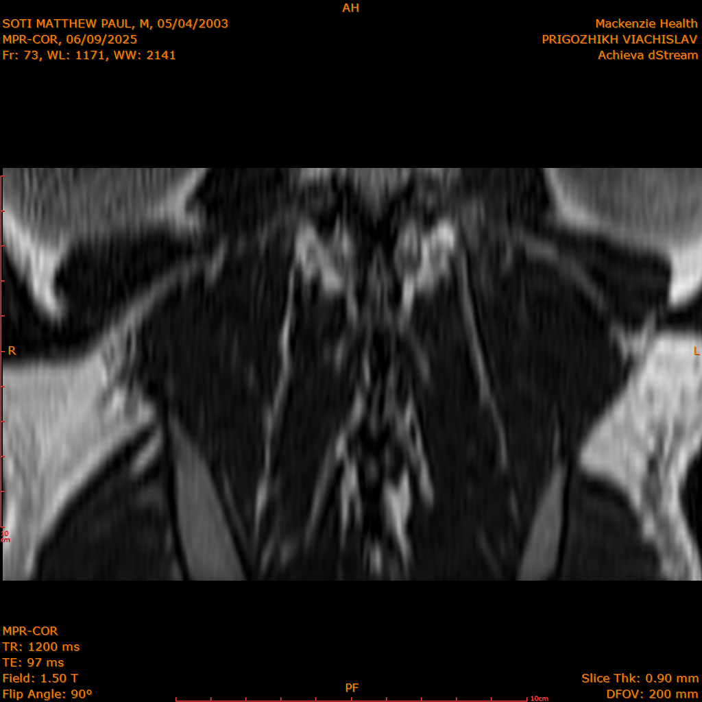 2025-06-09/MPR-COR/0074-IM135.png