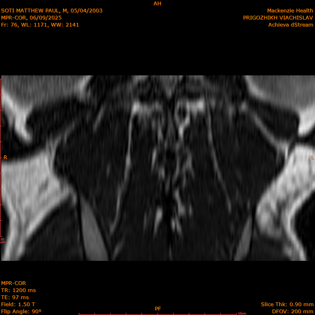 2025-06-09/MPR-COR/0077-IM138.png
