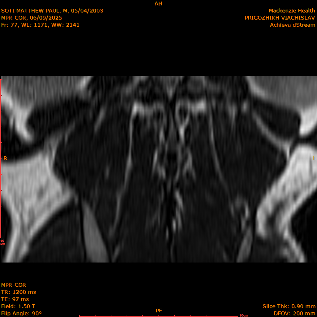 2025-06-09/MPR-COR/0078-IM139.png