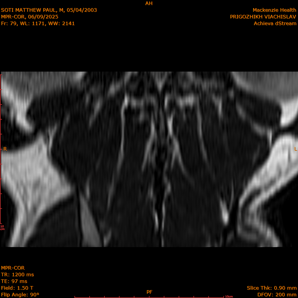 2025-06-09/MPR-COR/0080-IM141.png