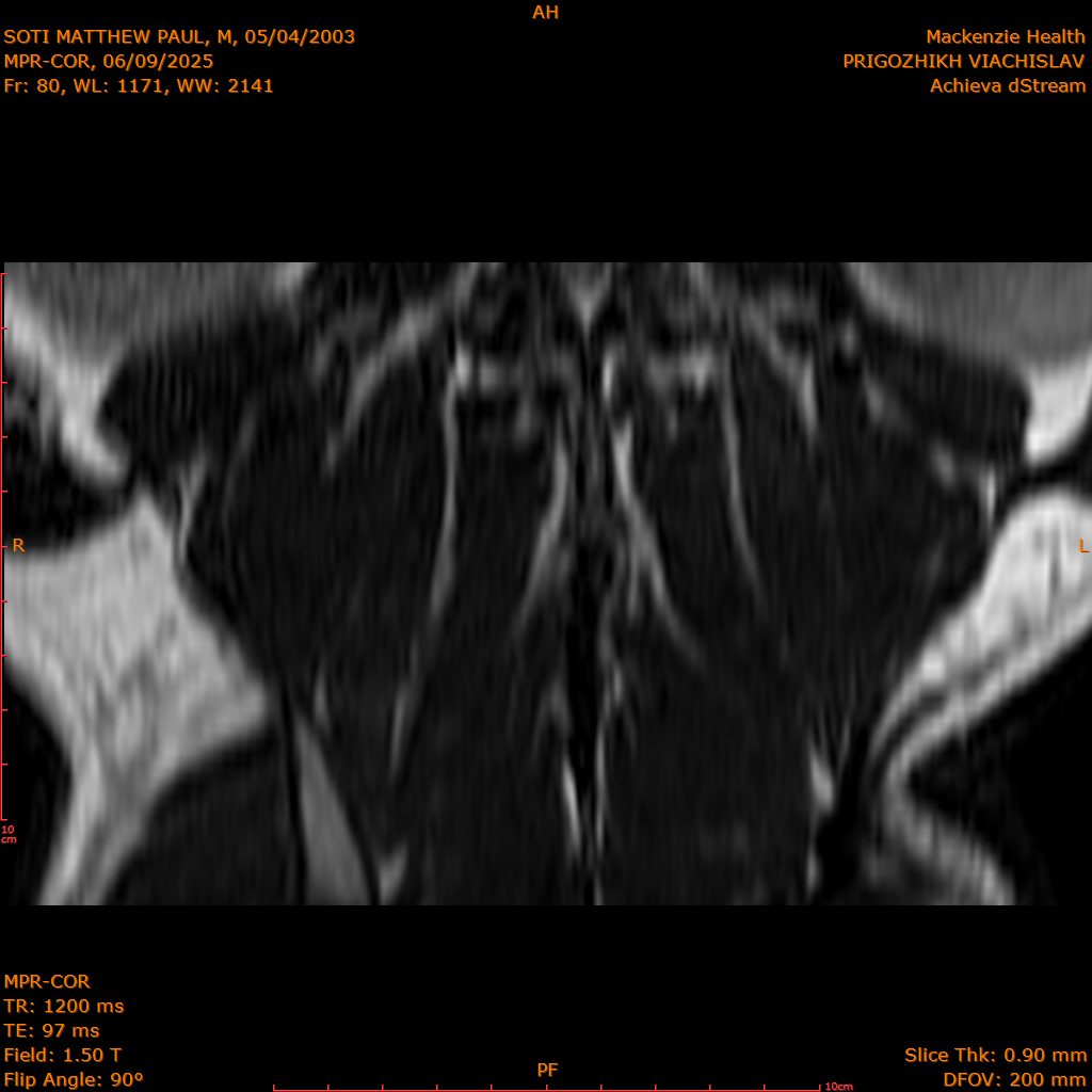 2025-06-09/MPR-COR/0081-IM142.png