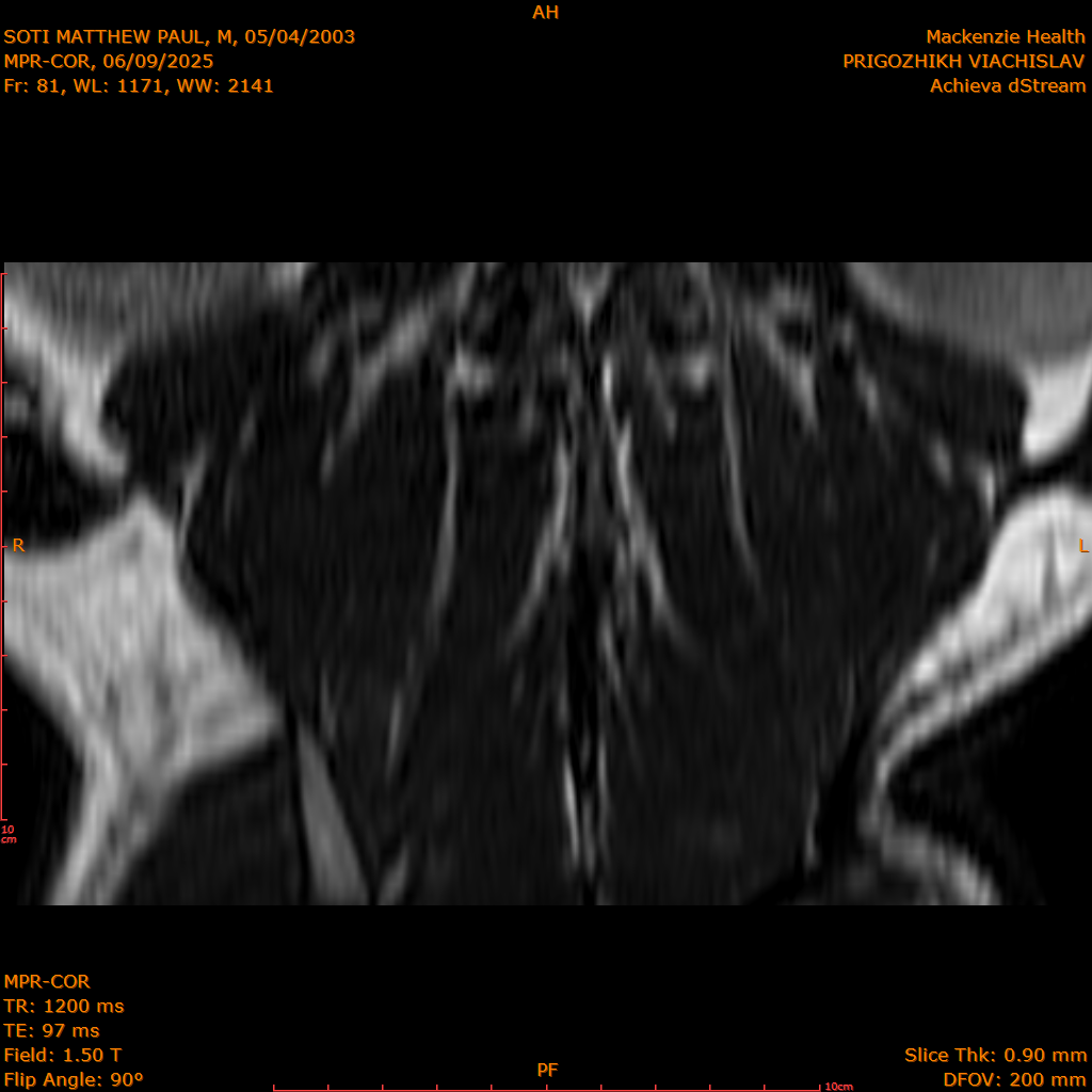 2025-06-09/MPR-COR/0082-IM143.png