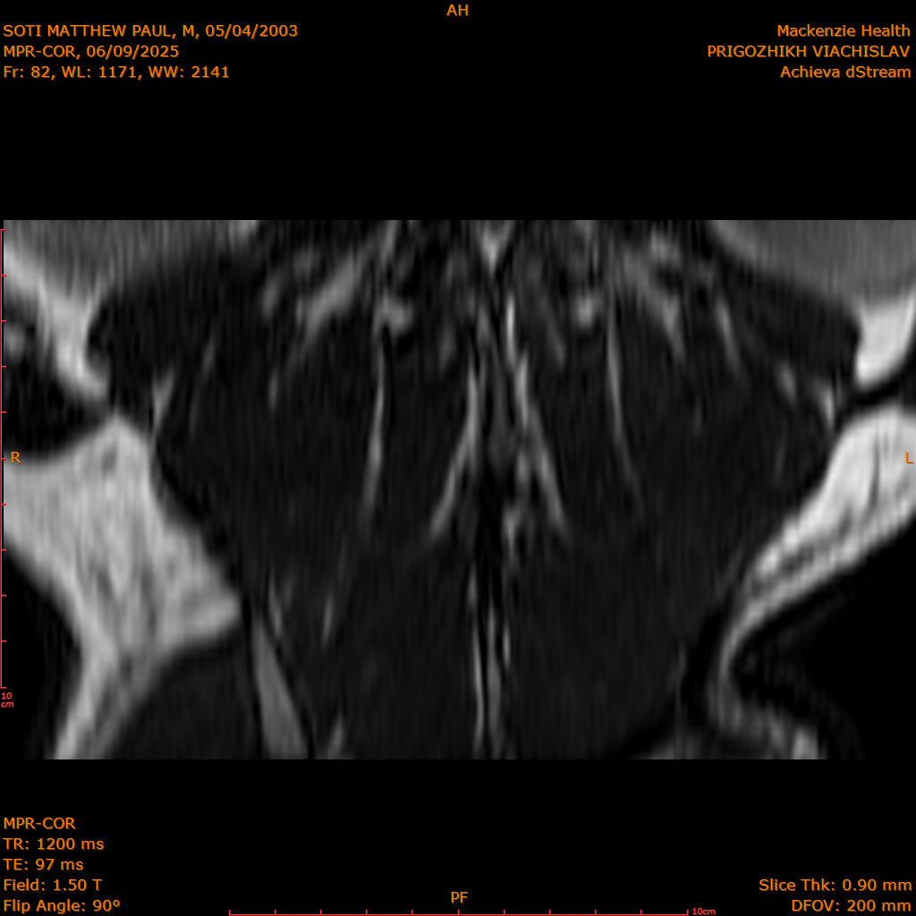 2025-06-09/MPR-COR/0083-IM144.png