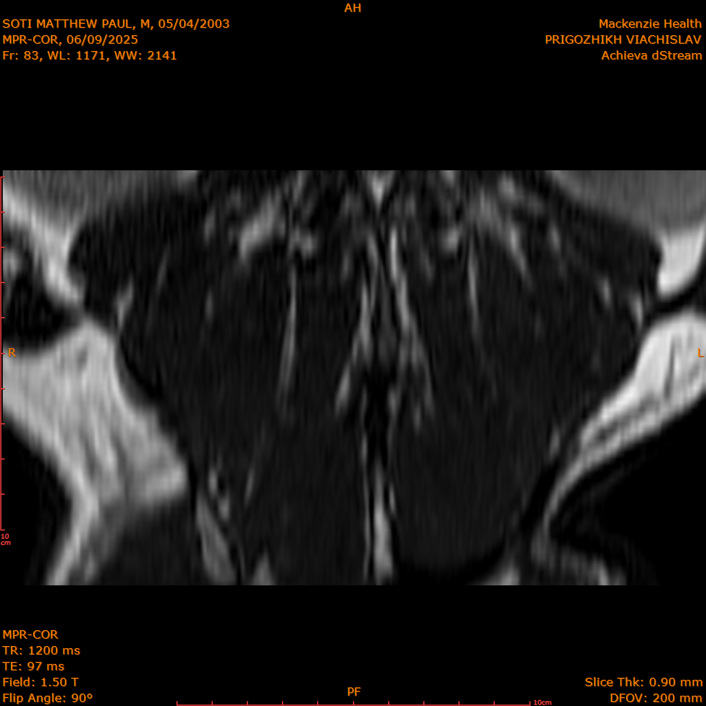 2025-06-09/MPR-COR/0084-IM145.png