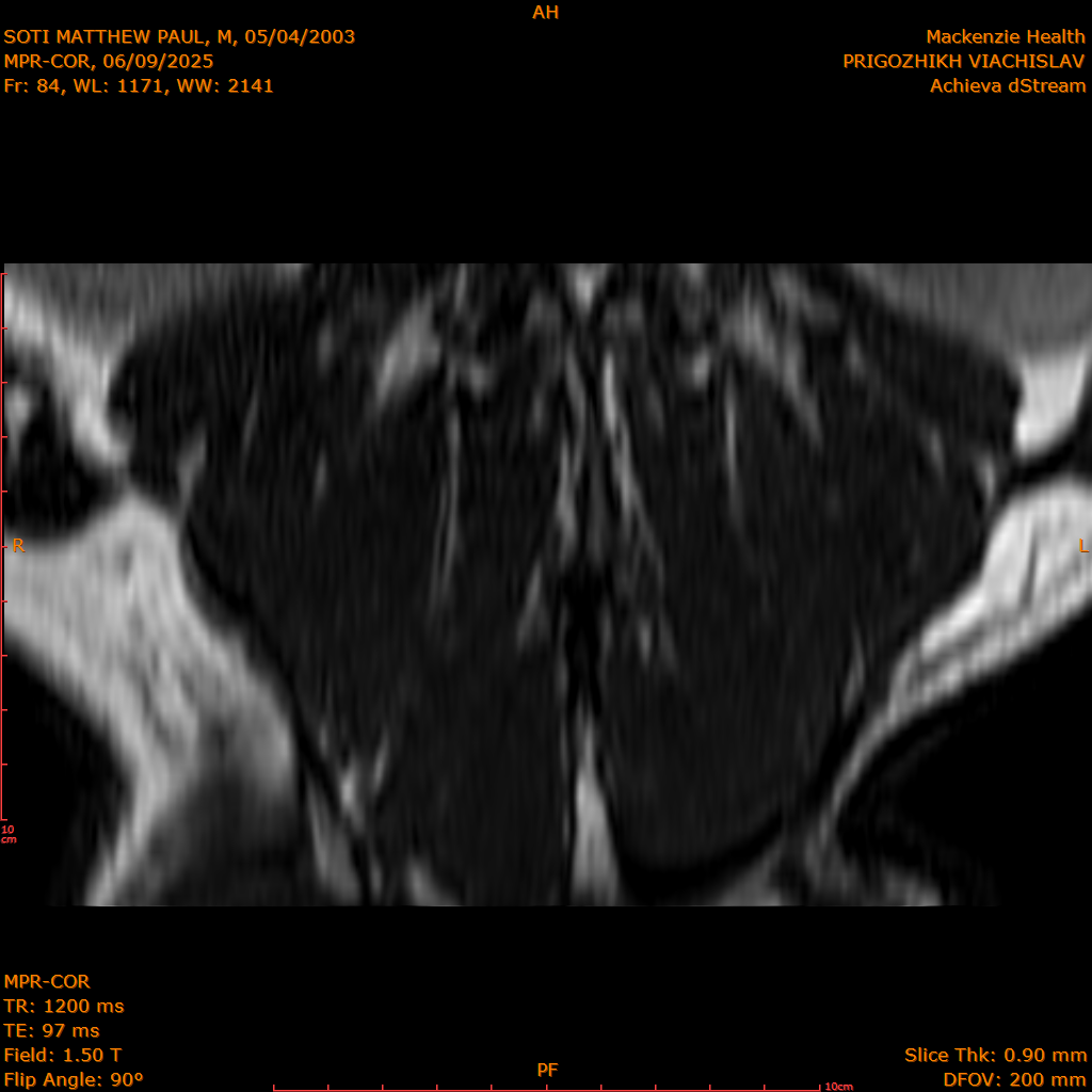 2025-06-09/MPR-COR/0085-IM146.png
