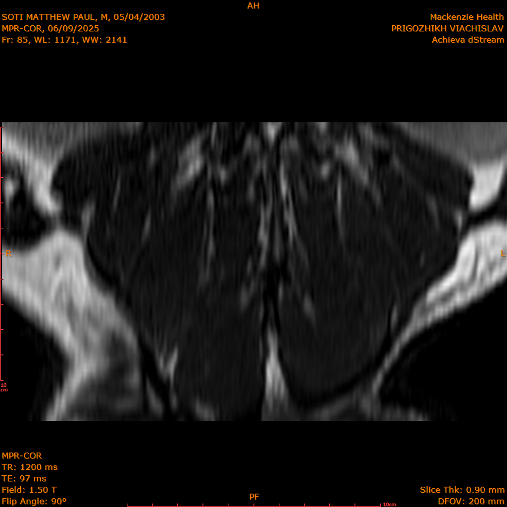 2025-06-09/MPR-COR/0086-IM147.png