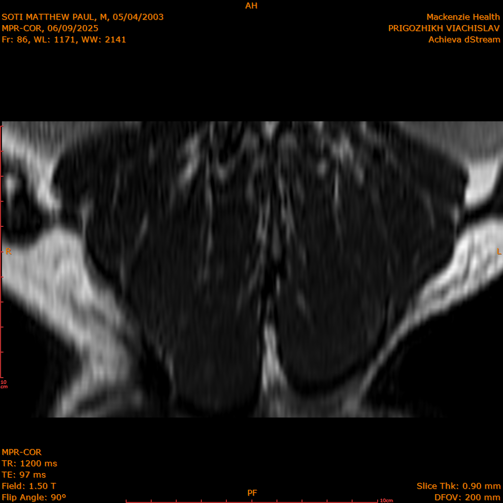 2025-06-09/MPR-COR/0087-IM148.png