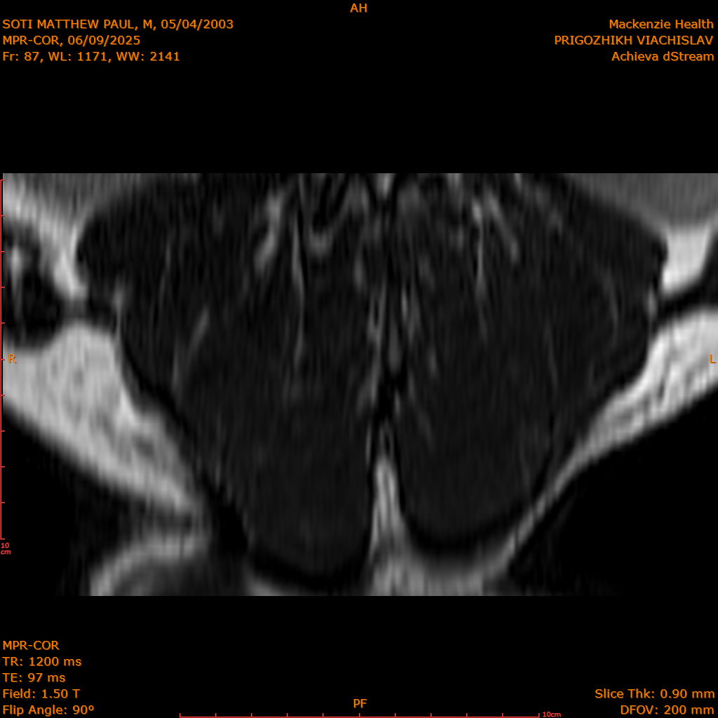 2025-06-09/MPR-COR/0088-IM149.png