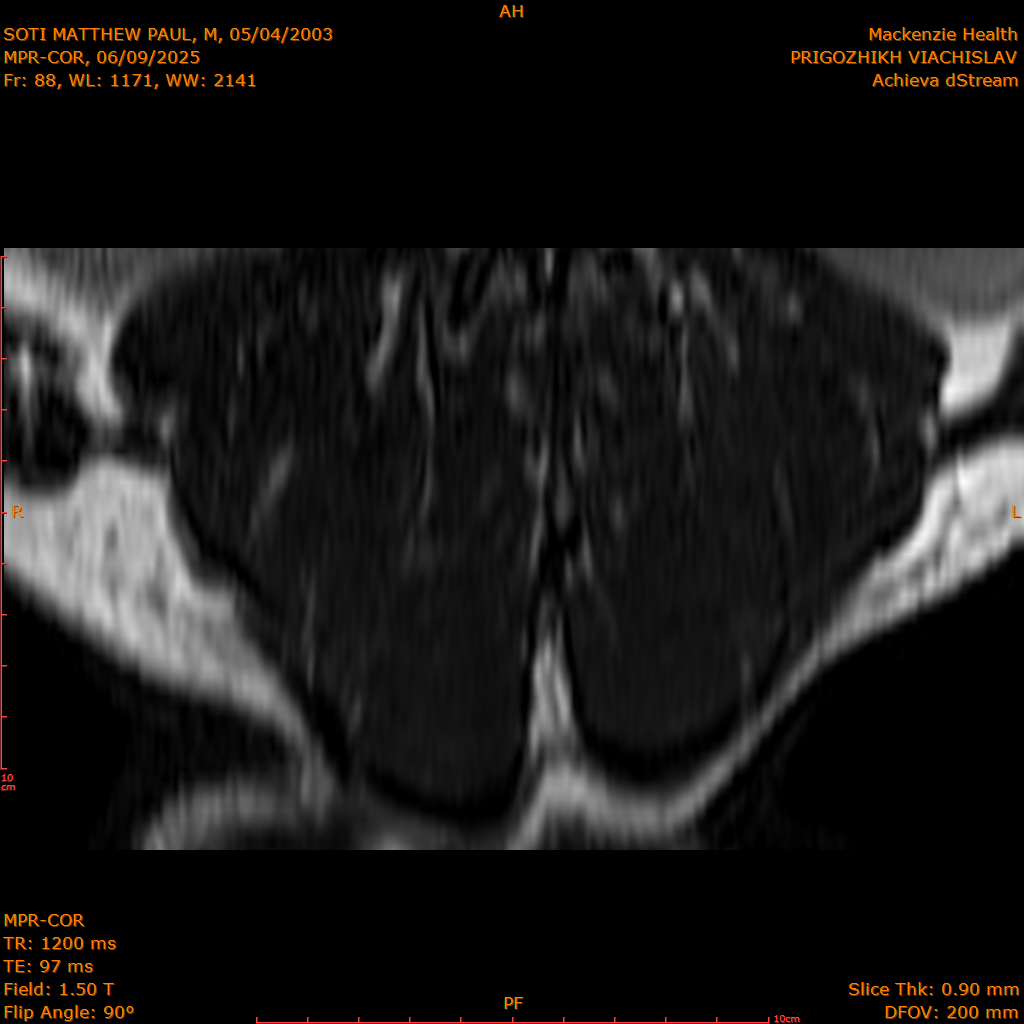 2025-06-09/MPR-COR/0089-IM150.png