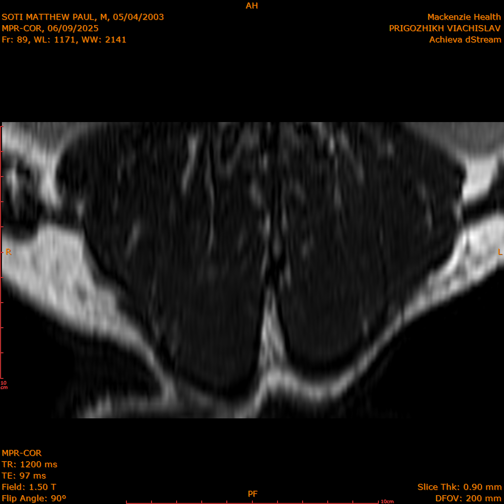2025-06-09/MPR-COR/0090-IM151.png