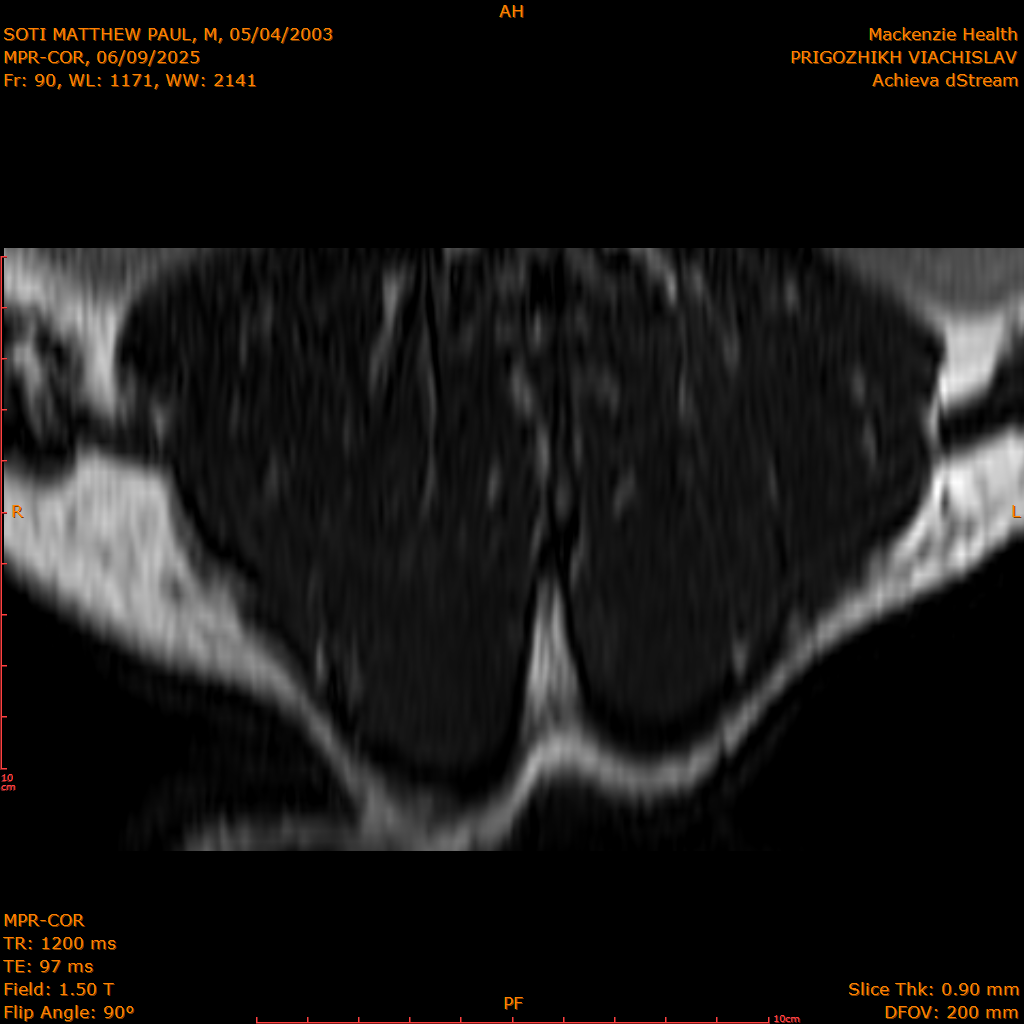 2025-06-09/MPR-COR/0091-IM152.png