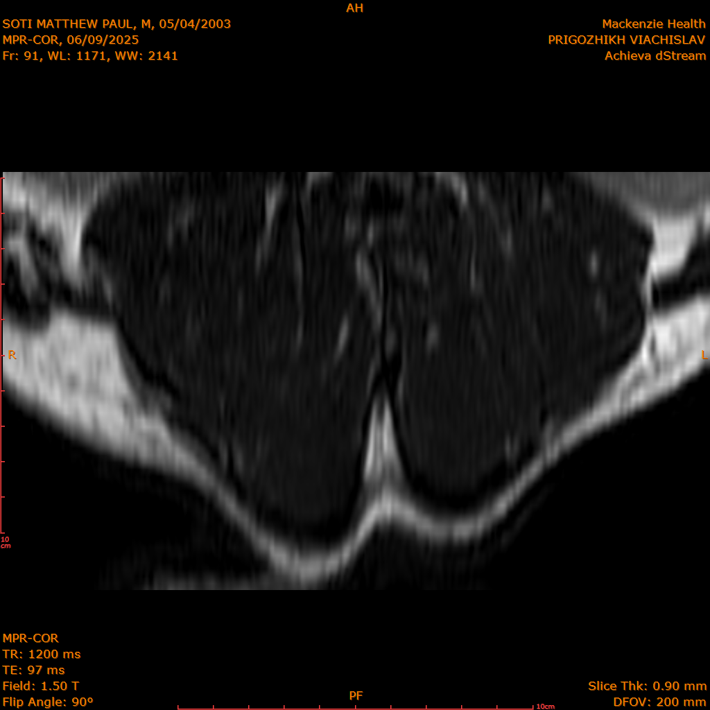 2025-06-09/MPR-COR/0092-IM153.png