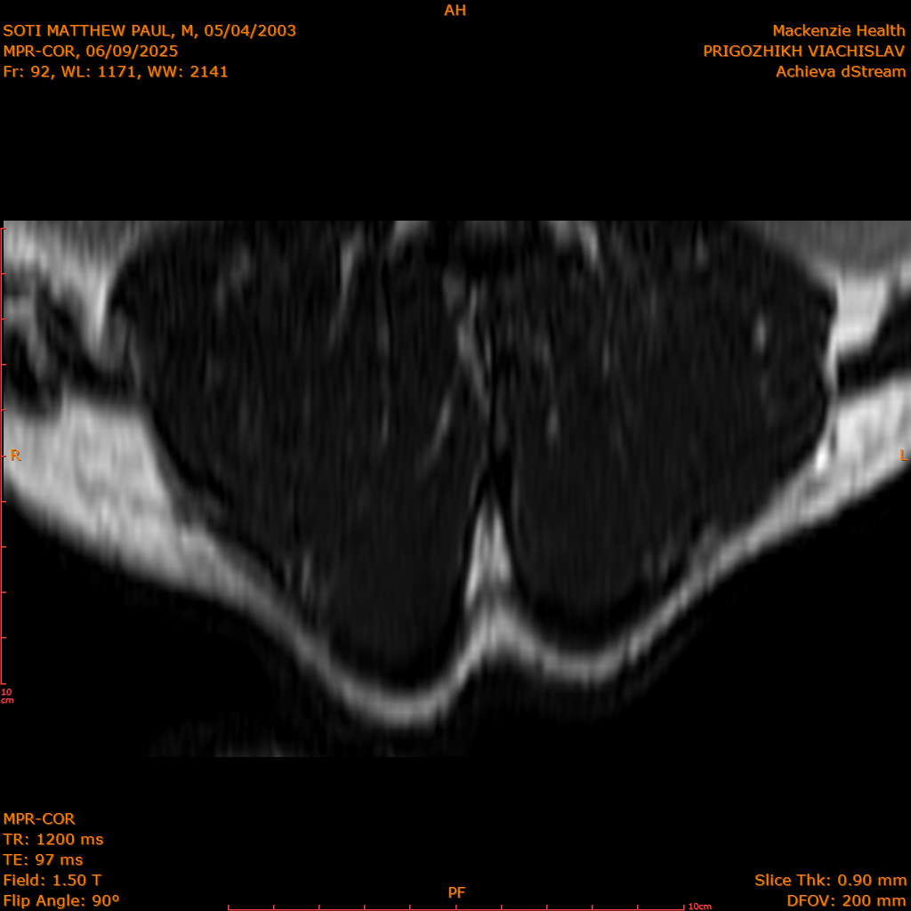 2025-06-09/MPR-COR/0093-IM154.png