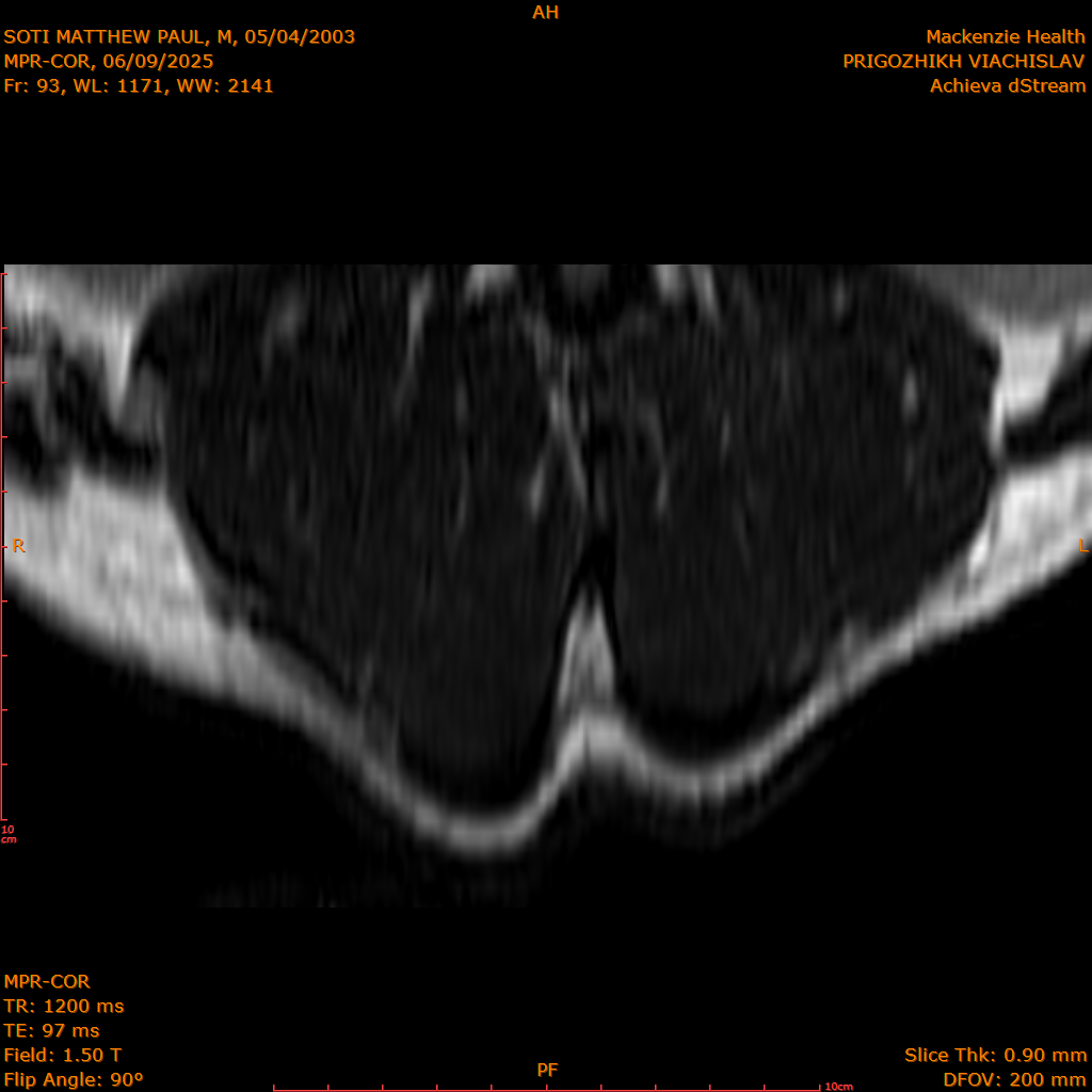 2025-06-09/MPR-COR/0094-IM155.png