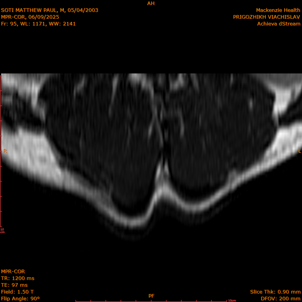 2025-06-09/MPR-COR/0096-IM157.png