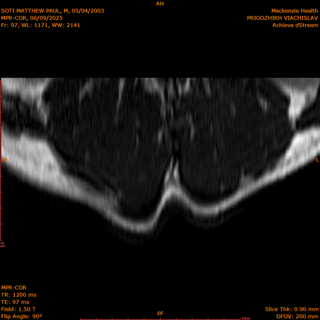 2025-06-09/MPR-COR/0098-IM159.png