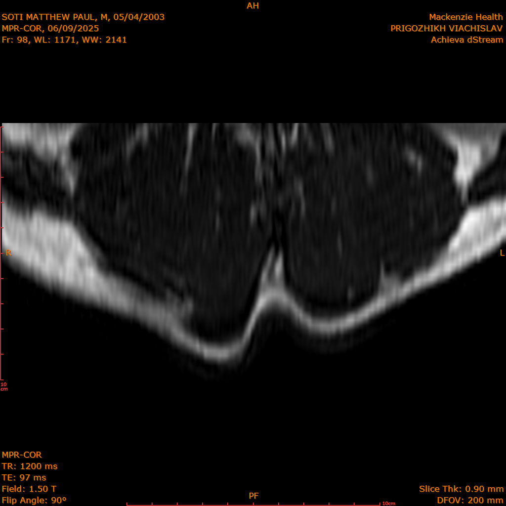2025-06-09/MPR-COR/0099-IM160.png