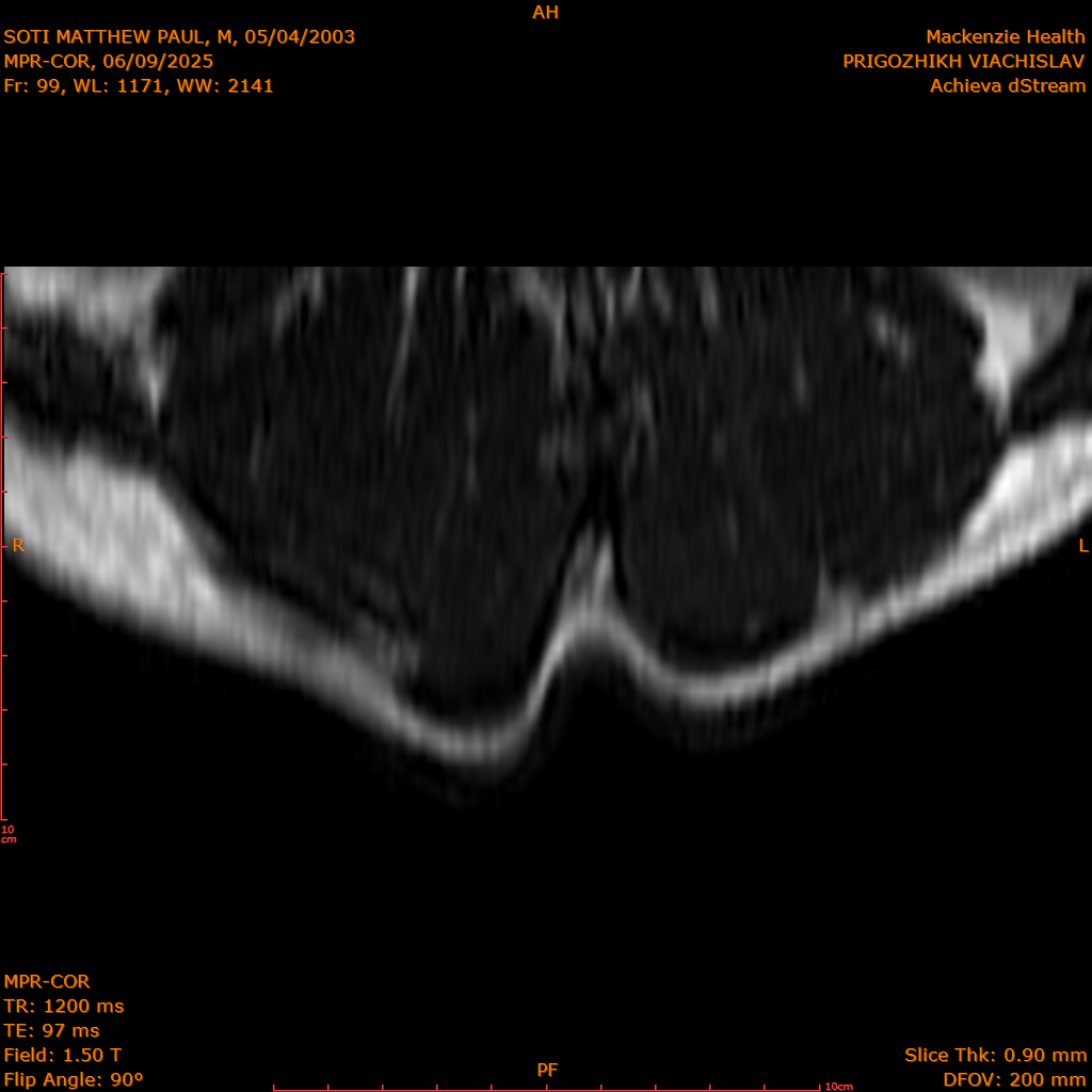 2025-06-09/MPR-COR/0100-IM161.png
