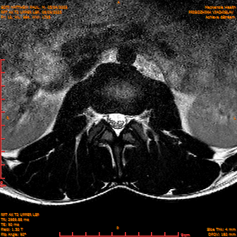 2025-06-09/RPT AX T2 UPPPER LSP/0014-IM236.png