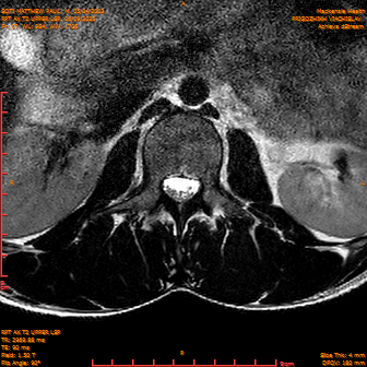 2025-06-09/RPT AX T2 UPPPER LSP/0018-IM240.png