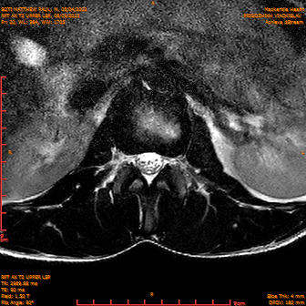 2025-06-09/RPT AX T2 UPPPER LSP/0021-IM243.png