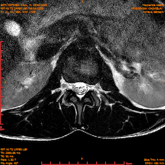 2025-06-09/RPT AX T2 UPPPER LSP/0022-IM244.png
