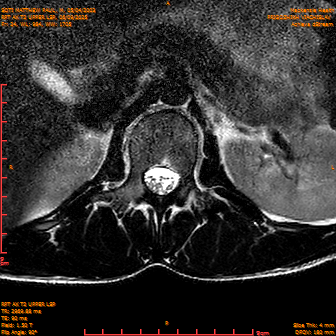 2025-06-09/RPT AX T2 UPPPER LSP/0025-IM247.png