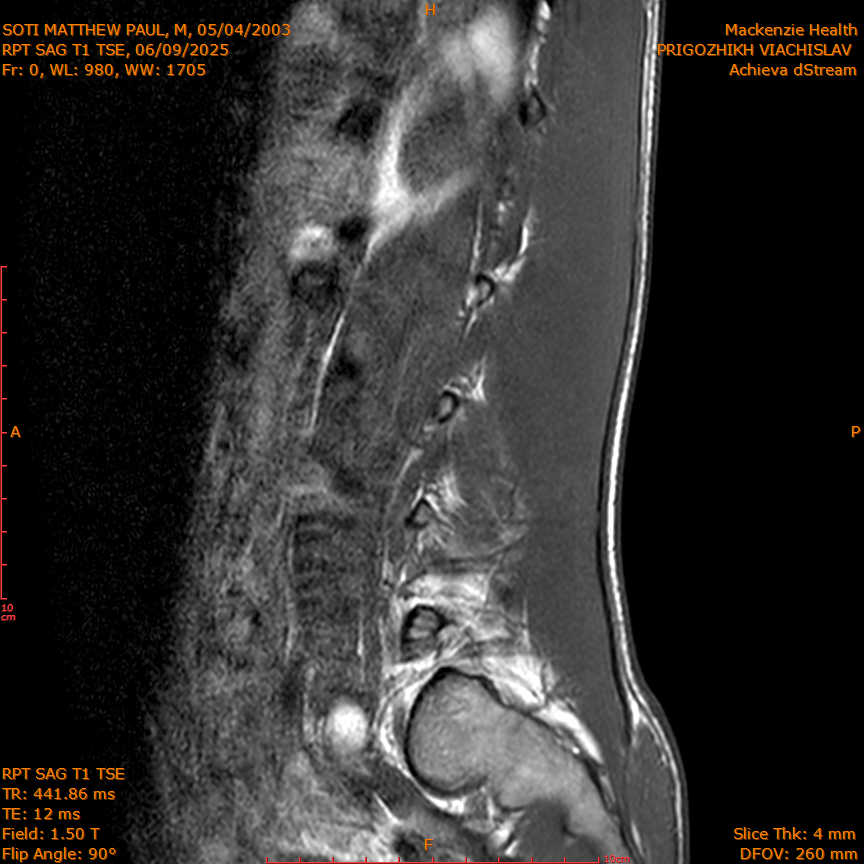 2025-06-09/RPT SAG T1 TSE/0001-IM208.png