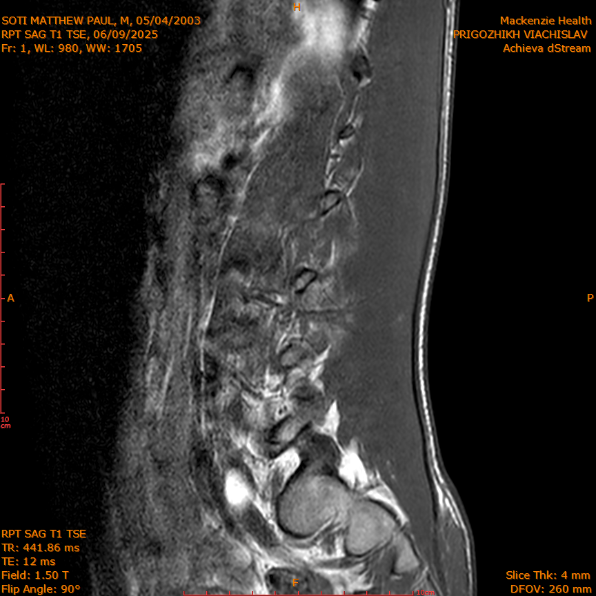 2025-06-09/RPT SAG T1 TSE/0002-IM209.png