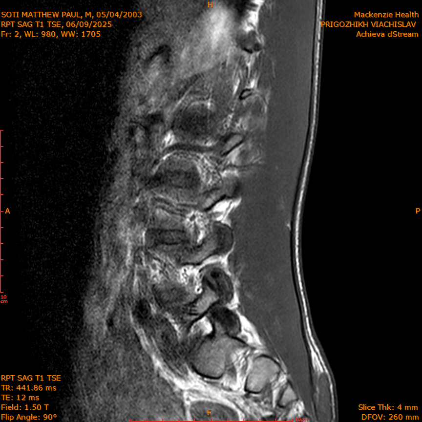 2025-06-09/RPT SAG T1 TSE/0003-IM210.png