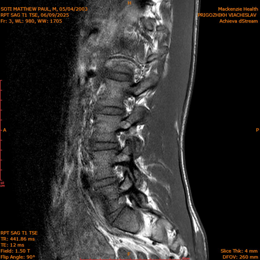 2025-06-09/RPT SAG T1 TSE/0004-IM211.png