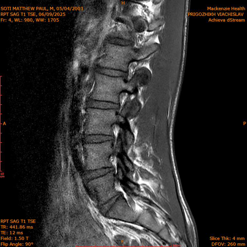 2025-06-09/RPT SAG T1 TSE/0005-IM212.png